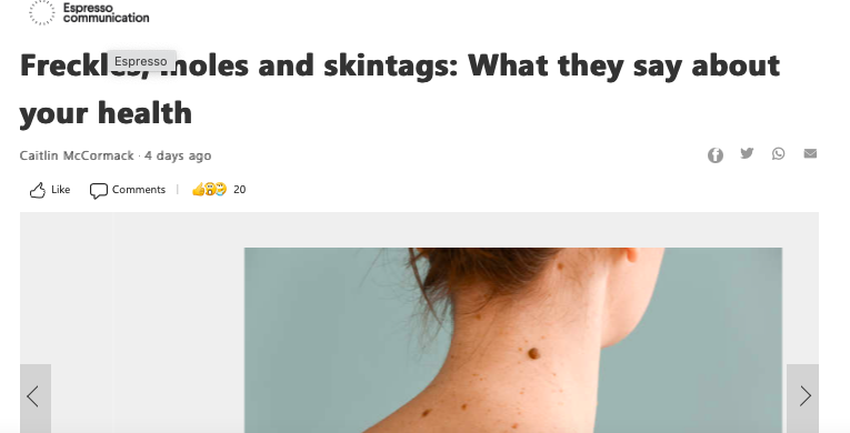 Freckles, moles and skintags: What they say about your health